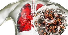 پای ویروس کرونا دوباره به ایران باز شد + جزئیات