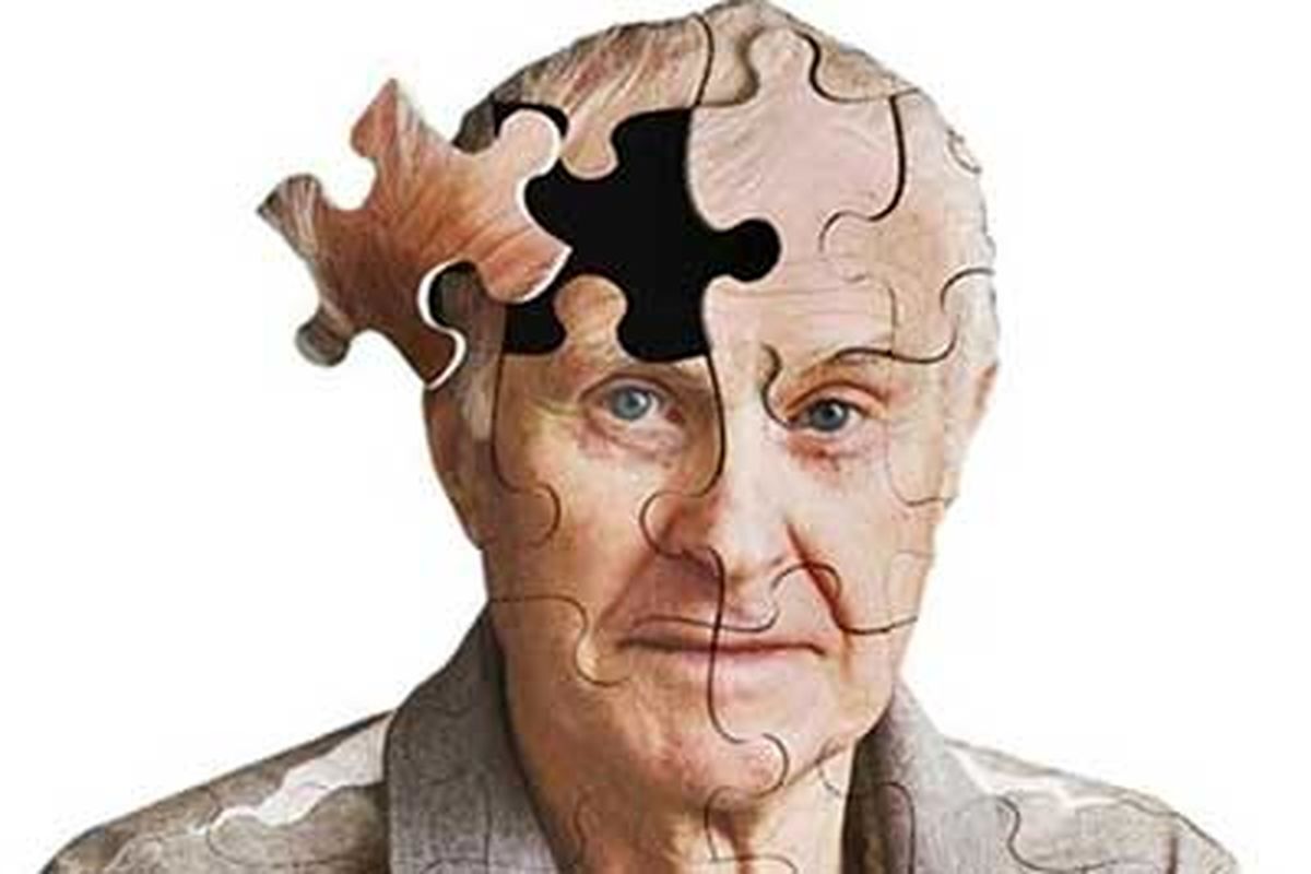 تشخیص ابتلا به آلزایمر با علامتی ساده