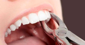 ۵ خوراکی مناسب پس از کشیدن دندان چیست؟