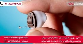 قیمت بهترین سمعک نامرئی چند است؟