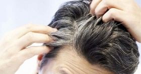 عوامل موثر بر سفید شدن مو / با موهایتان ملایم رفتار کنید