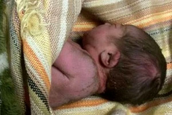 نوزادی که باعث برکناری رییس بیمارستان شد!