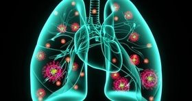 کرونا باعث ذات‌الریه می شود؟