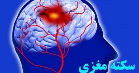 شایعه ارتباط کرونا با سکته مغزی