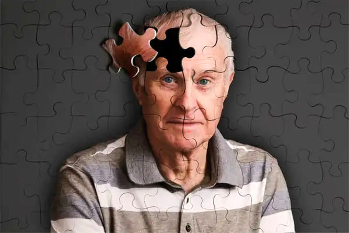 یک خبر خوش برای مبتلایان به آلزایمر