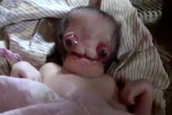 با دیدن این عکس شوکه می شوید / ترسناک ترین نوزاد به دنیا آمد! 