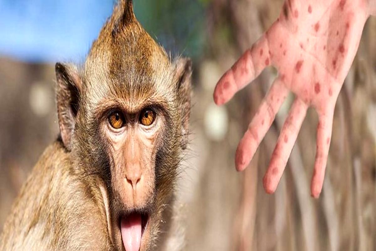 پایان وضعیت اضطراری جهانی در مورد آبله میمون