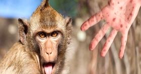 پایان وضعیت اضطراری جهانی در مورد آبله میمون