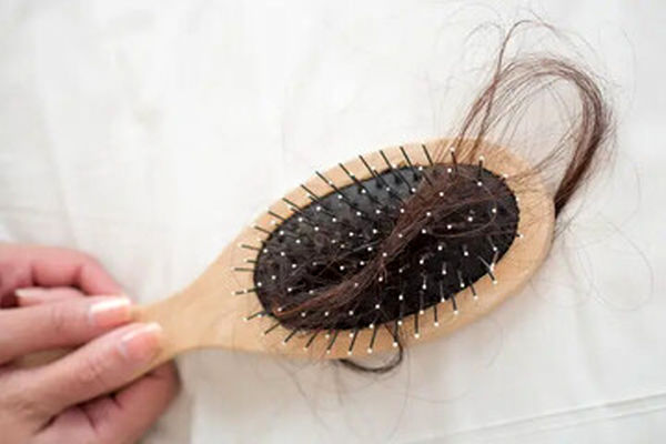 آیا می‌توان از ریزش مو جلوگیری کرد؟

