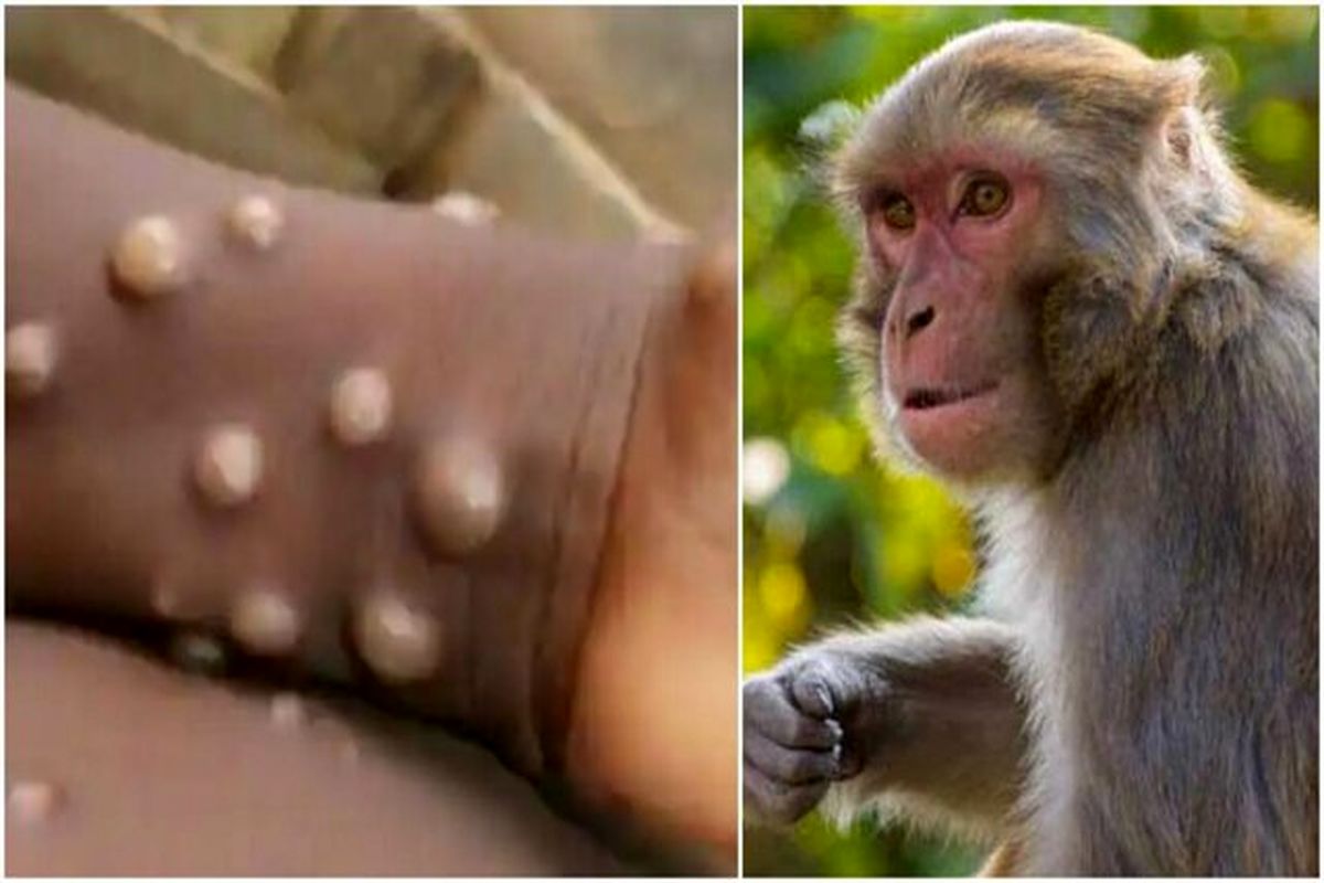 بیماری آبله میمون از کجا آب می خورد؟