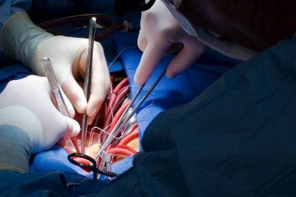 وضعیت عجیب دستمزد جراحان قلب در بیمارستان‌های دولتی