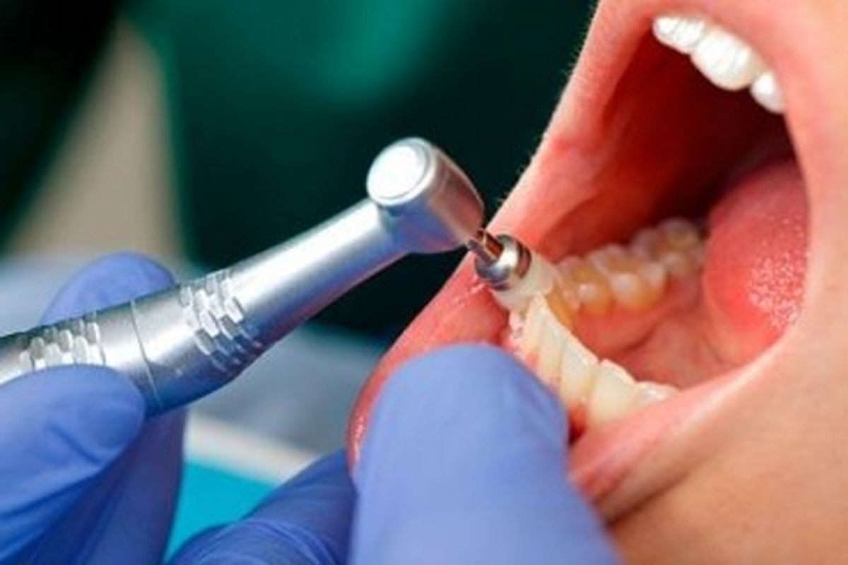 زمان ثبت نام آزمون ملی دانش آموختگان دندانپزشکی