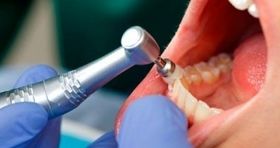 زمان ثبت نام آزمون ملی دانش آموختگان دندانپزشکی