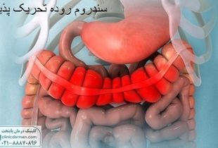 آیا سندروم روده تحریک پذیر باعث سرطان میشود [تحقیقات جدید و پزشکان چه می گویند]

