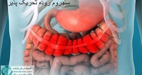 آیا سندروم روده تحریک پذیر باعث سرطان میشود [تحقیقات جدید و پزشکان چه می گویند]

