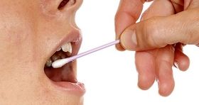 تشخیص سرطان از طریق بزاق دهان ممکن شد